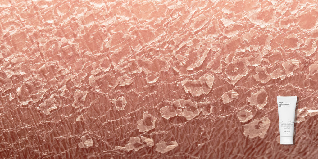 5 Signs You've Damaged Your Skin Barrier