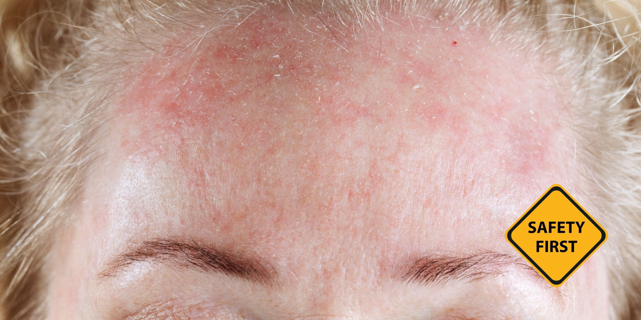 Should You Exfoliate? The Real Science Behind Exfoliation, Skin Renewa