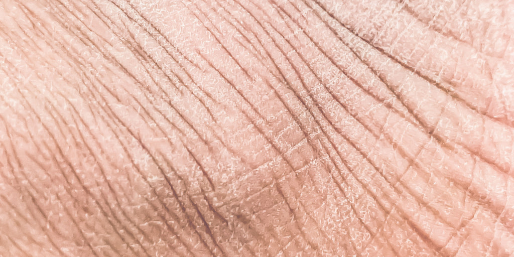 The Three Types of Wrinkles on Your Face (And Why Your Cream Only Fixes One of Them)