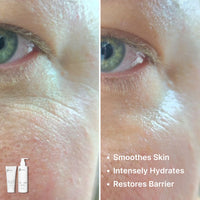 Close-up before-and-after skin near the eye, showing reduced dryness and smoother texture. Text: Smoothes Skin, Intensely Hydrates, Restores Barrier. Two Basic Maintenance Picture-Perfect Face System bottles appear in the corner.