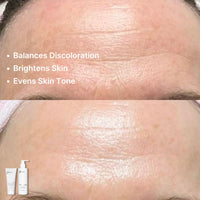 Close-up of a forehead with before-after results: the top shows fine lines and uneven skin tone; the bottom, smoother, brighter skin. Text highlights benefits of Basic Maintenance’s Picture-Perfect Face System.