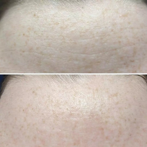 Taylor, 39 (37 Days)