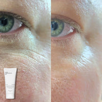 Side-by-side close-up of skin around an eye: the left shows visible pores and texture, while the right looks smoother after using The Face Lotion by Basic Maintenance. The product tube is visible in the bottom left corner.