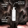 A white bottle of The Shampoo by Basic Maintenance is shown between two close-ups of a dandruff-affected scalp. Text reads: restores scalp, controls oiliness, and destroys dandruff, with arrows pointing to the scalp and bottle.