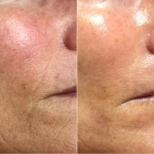 Theresa, 65 (53 Days)